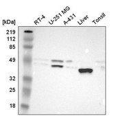 Anti-PON1 antibody produced in rabbit Prestige Antibodies® Powered by Atlas Antibodies, affinity isolated antibody, buffered aqueous glycerol solution