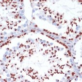 Anti-Phospho-γH2A.X-S139 antibody produced in rabbit