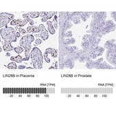 Anti-LIN28B antibody produced in rabbit Prestige Antibodies® Powered by Atlas Antibodies, affinity isolated antibody, buffered aqueous glycerol solution