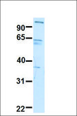 Anti-SUV420H1 antibody produced in rabbit affinity isolated antibody