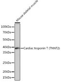 Anti-Cardiac troponin T (TNNT2) Antibody, clone 10H9D8, Rabbit Monoclonal