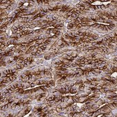 Anti-CHGA antibody produced in rabbit Prestige Antibodies® Powered by Atlas Antibodies, affinity isolated antibody, buffered aqueous glycerol solution