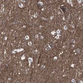 Anti-SSTR2 antibody produced in rabbit Prestige Antibodies® Powered by Atlas Antibodies, affinity isolated antibody, buffered aqueous glycerol solution