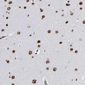 Anti-ATRX antibody produced in rabbit Prestige Antibodies® Powered by Atlas Antibodies, affinity isolated antibody, buffered aqueous glycerol solution