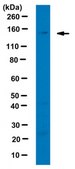 Anti-Pro-Collagen Type I, A1/COL1A1 from rabbit, purified by affinity chromatography