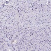 Anti-KCNQ2 antibody produced in rabbit Prestige Antibodies® Powered by Atlas Antibodies, affinity isolated antibody, buffered aqueous glycerol solution
