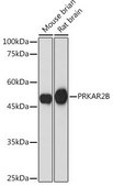 Anti-PRKAR2B antibody produced in rabbit