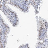 Anti-MAN1A2 antibody produced in rabbit Prestige Antibodies® Powered by Atlas Antibodies, affinity isolated antibody, buffered aqueous glycerol solution
