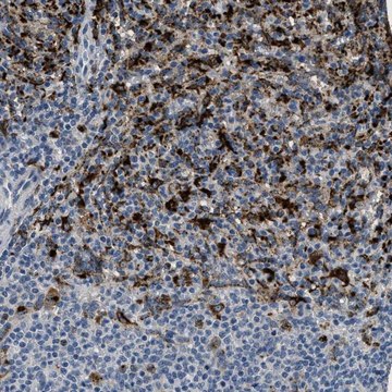 Anti-BMPR2 antibody produced in rabbit Prestige Antibodies® Powered by Atlas Antibodies, affinity isolated antibody, buffered aqueous glycerol solution