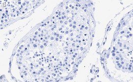 Anti-Centrin Antibody, clone 20H5 ZooMAb® Mouse Monoclonal recombinant, expressed in HEK 293 cells