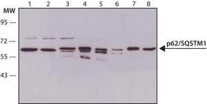 Anti-p62/SQSTM1 antibody produced in rabbit ~1 mg/mL, affinity isolated antibody, buffered aqueous solution