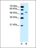 Anti-SLC12A1 antibody produced in rabbit affinity isolated antibody
