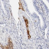 Anti-PLAT antibody produced in rabbit Prestige Antibodies® Powered by Atlas Antibodies, affinity isolated antibody, buffered aqueous glycerol solution