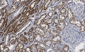 Anti-SDHB Antibody, clone 1H11 ZooMAb® Rabbit Monoclonal recombinant, expressed in HEK 293 cells