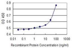Monoclonal Anti-A2M antibody produced in mouse clone 2B5, purified immunoglobulin, buffered aqueous solution