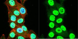 抗SNF2β / BRG1抗体 serum, Upstate®