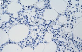 Anti-Bcl-xL Antibody, clone 1O8 ZooMAb® Rabbit Monoclonal recombinant, expressed in HEK 293 cells