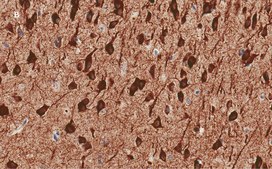 Anti-MAP2 Antibody, clone 3C19, ZooMAb® Rabbit Monoclonal recombinant, expressed in HEK 293 cells