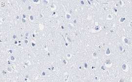 Anti-Lamin A/C Antibody, clone 2B10 ZooMAb® Rabbit Monoclonal recombinant, expressed in HEK 293 cells