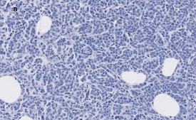 Anti-phospho-IRS1 (Tyr612) Antibody, clone 1N14, ZooMAb® Rabbit Monoclonal recombinant, expressed in HEK 293 cells