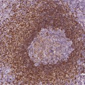 Anti-ALOX5 antibody produced in rabbit Prestige Antibodies® Powered by Atlas Antibodies, affinity isolated antibody