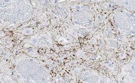Anti-Calretinin Antibody, clone 6B8.2 ZooMAb® Mouse Monoclonal recombinant, expressed in HEK 293 cells