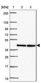 Anti-TWF2 antibody produced in rabbit Prestige Antibodies® Powered by Atlas Antibodies, affinity isolated antibody, buffered aqueous glycerol solution
