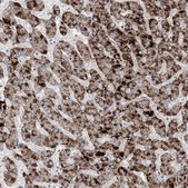 Anti-AGXT antibody produced in rabbit Prestige Antibodies® Powered by Atlas Antibodies, affinity isolated antibody, buffered aqueous glycerol solution
