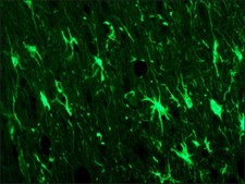 Anti-Glial Fibrillary Acidic Protein antibody, Mouse monoclonal clone G-A-5, purified from hybridoma cell culture