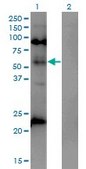 Monoclonal Anti-MECP2 antibody produced in mouse clone 4B6, purified immunoglobulin, buffered aqueous solution