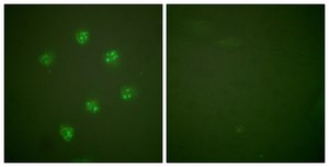 Anti-KI67 antibody produced in rabbit affinity isolated antibody