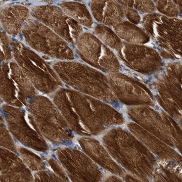 Anti-SLC16A3 antibody produced in rabbit Prestige Antibodies® Powered by Atlas Antibodies, affinity isolated antibody, buffered aqueous glycerol solution