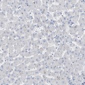 Anti-RSPH4A antibody produced in rabbit Prestige Antibodies® Powered by Atlas Antibodies, affinity isolated antibody, buffered aqueous glycerol solution