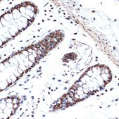 Anti-HMGB2 antibody produced in rabbit