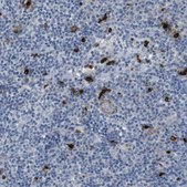 Anti-GZMM antibody produced in rabbit Prestige Antibodies® Powered by Atlas Antibodies, affinity isolated antibody, buffered aqueous glycerol solution