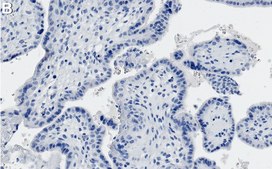 Anti-Ago 1 Antibody, clone 1L3 ZooMAb® Rabbit Monoclonal recombinant, expressed in HEK 293 cells