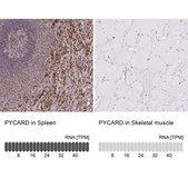 Anti-PYCARD antibody produced in rabbit Prestige Antibodies® Powered by Atlas Antibodies, affinity isolated antibody, buffered aqueous glycerol solution