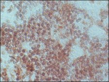 抗-组蛋白脱乙酰基酶1(HDAC1) 兔抗 IgG fraction of antiserum, buffered aqueous solution