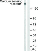 Anti-Calcium Sensing Receptor antibody produced in rabbit affinity isolated antibody