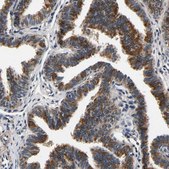 Anti-RUVBL1 antibody produced in rabbit Prestige Antibodies® Powered by Atlas Antibodies, affinity isolated antibody, buffered aqueous glycerol solution, Ab2