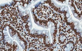 Anti-nAChR α4 Subunit Antibody, clone 369 clone 369, from mouse