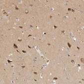 Anti-HTT antibody produced in rabbit Prestige Antibodies® Powered by Atlas Antibodies, affinity isolated antibody, buffered aqueous glycerol solution