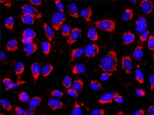 单克隆抗-胶原，X型 小鼠抗 clone COL-10, ascites fluid
