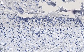 Anti-HSP70 Antibody, clone 4E12 ZooMAb® Rabbit Monoclonal recombinant, expressed in HEK 293 cells