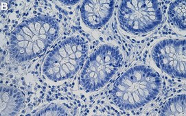 Anti-ASH2L Antibody, clone 2B4 ZooMAb® Rabbit Monoclonal recombinant, expressed in HEK 293 cells