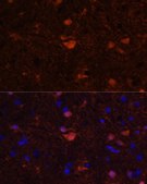 Anti-S100B antibody produced in rabbit