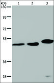 Anti-TDP2 antibody produced in rabbit affinity isolated antibody