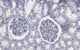 Anti-SLC12A3 Antibody, clone 3I12 ZooMAb® Rabbit Monoclonal recombinant, expressed in HEK 293 cells