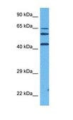 Anti-FOS (ab1) antibody produced in rabbit affinity isolated antibody