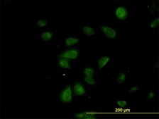 Monoclonal Anti-CDK5RAP3 antibody produced in mouse clone 1G4, purified immunoglobulin, buffered aqueous solution